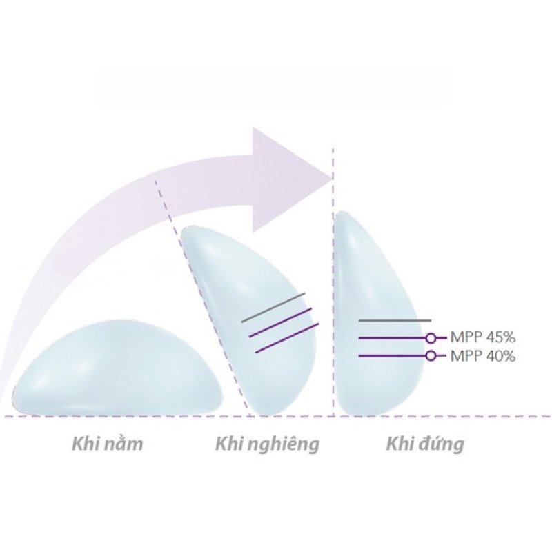 nang-nguc-nano-chip-ergonomix-giai-phap-hoan-hao-giup-chi-em-co-vong-1-cang-tron-quyen-ru