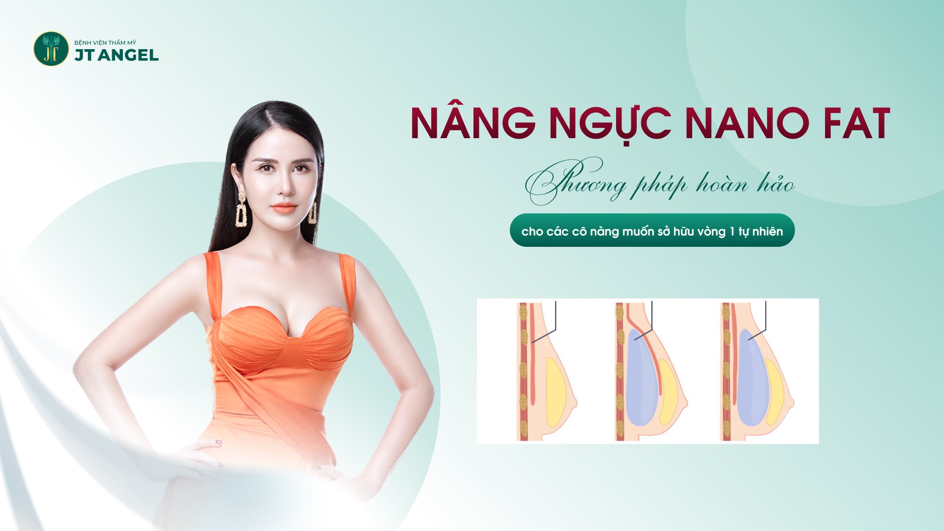 nang-nguc-nano-fat-phuong-phap-hoan-hao-cho-cac-co-nang-muon-so-huu-vong-1-tu-nhien