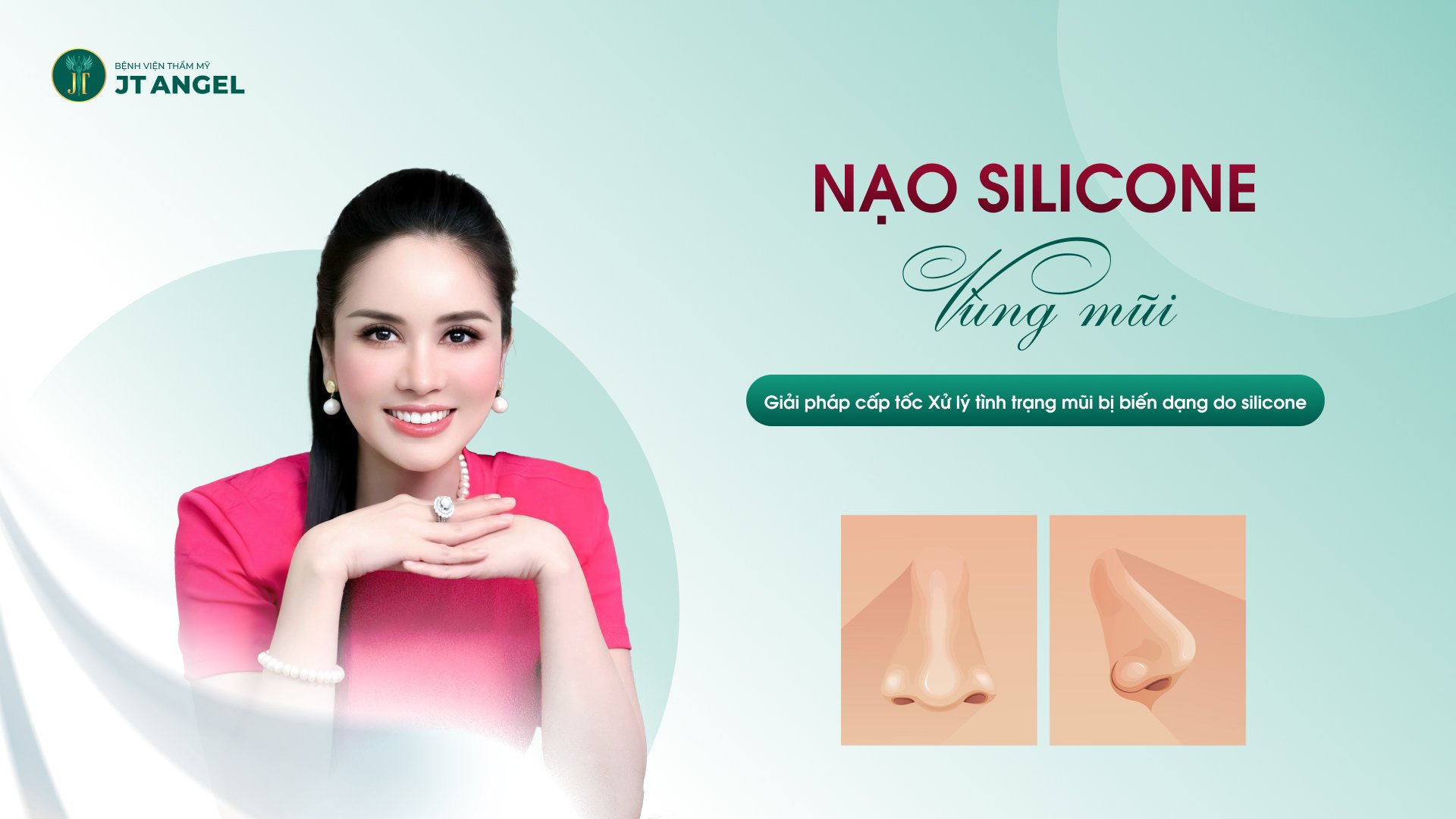 Nạo silicone vùng mũi: Giải pháp cấp tốc xử lý tình trạng mũi bị biến dạng do silicon