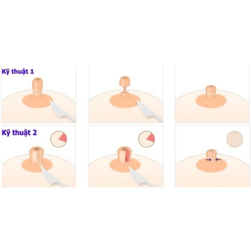 thu-nho-dau-nhu-hoa-nhung-thay-doi-tich-cuc-trong-cuoc-song-cua-phu-nu