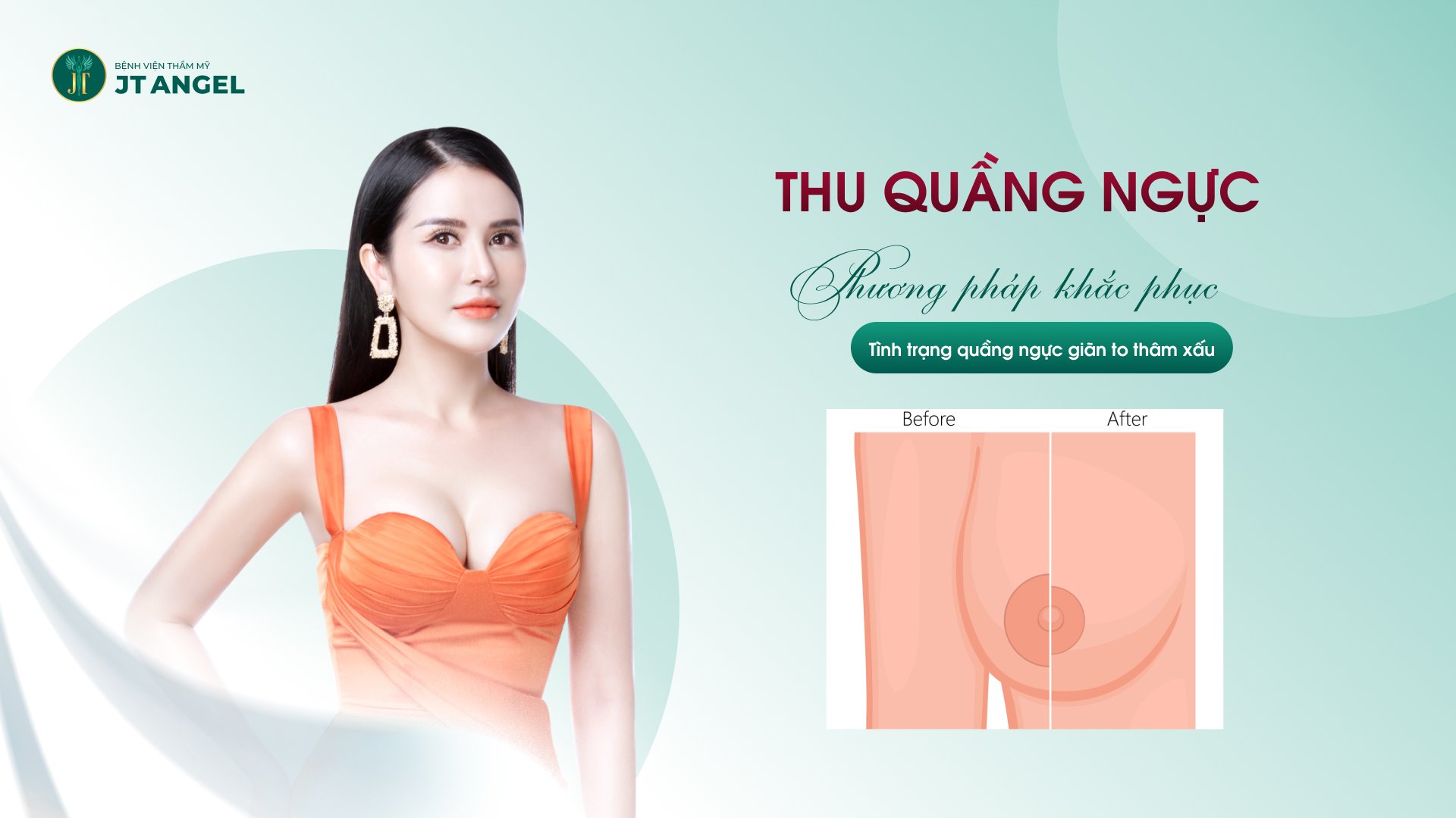 thu-quang-nguc-phuong-phap-khac-phuc-tinh-trang-quang-nguc-gian-to-tham-xau