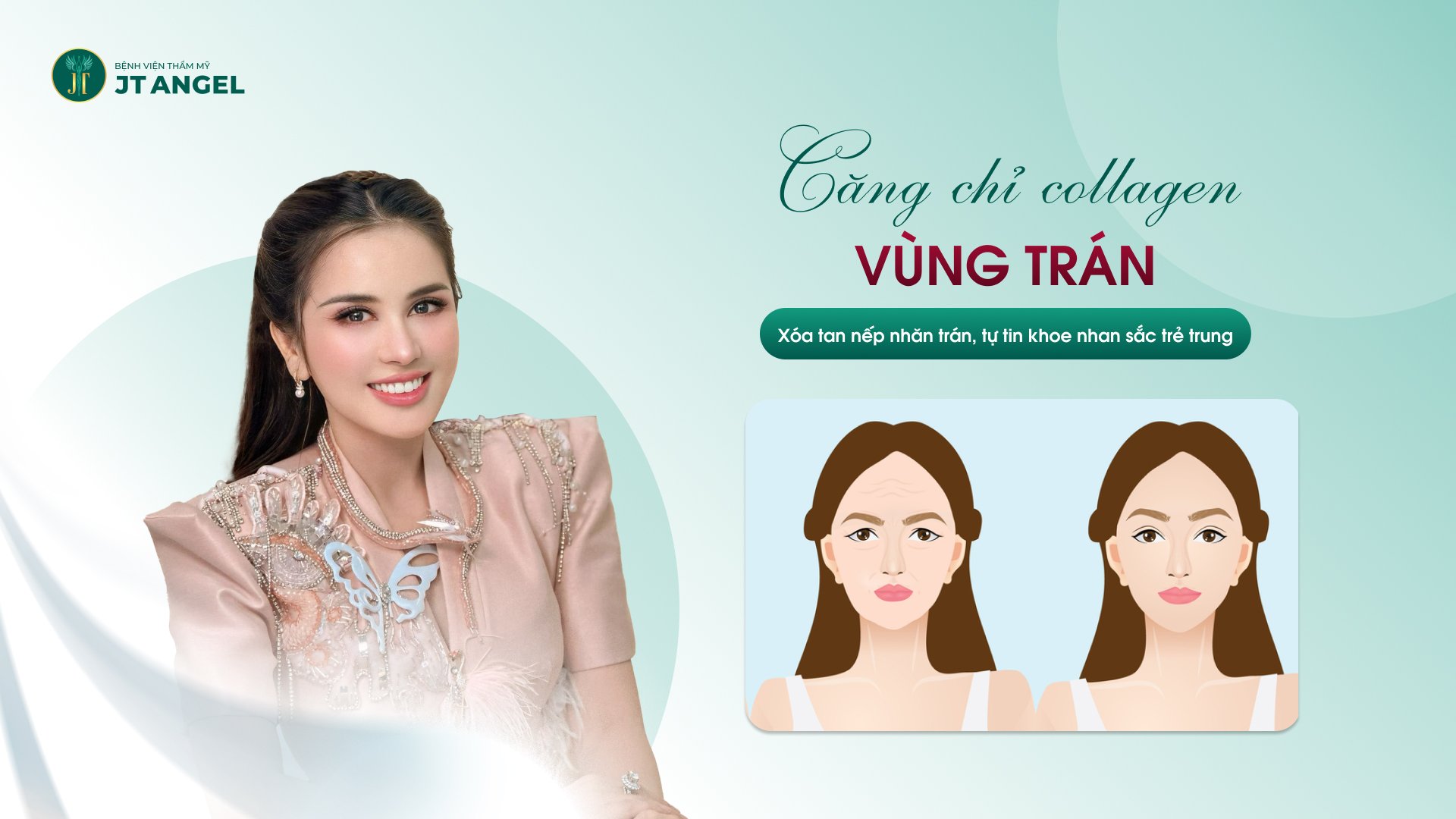 cang-chi-collagen-vung-tran-xoa-tan-nep-nhan-tran-tu-tin-khoe-nhan-sac-tre-trung