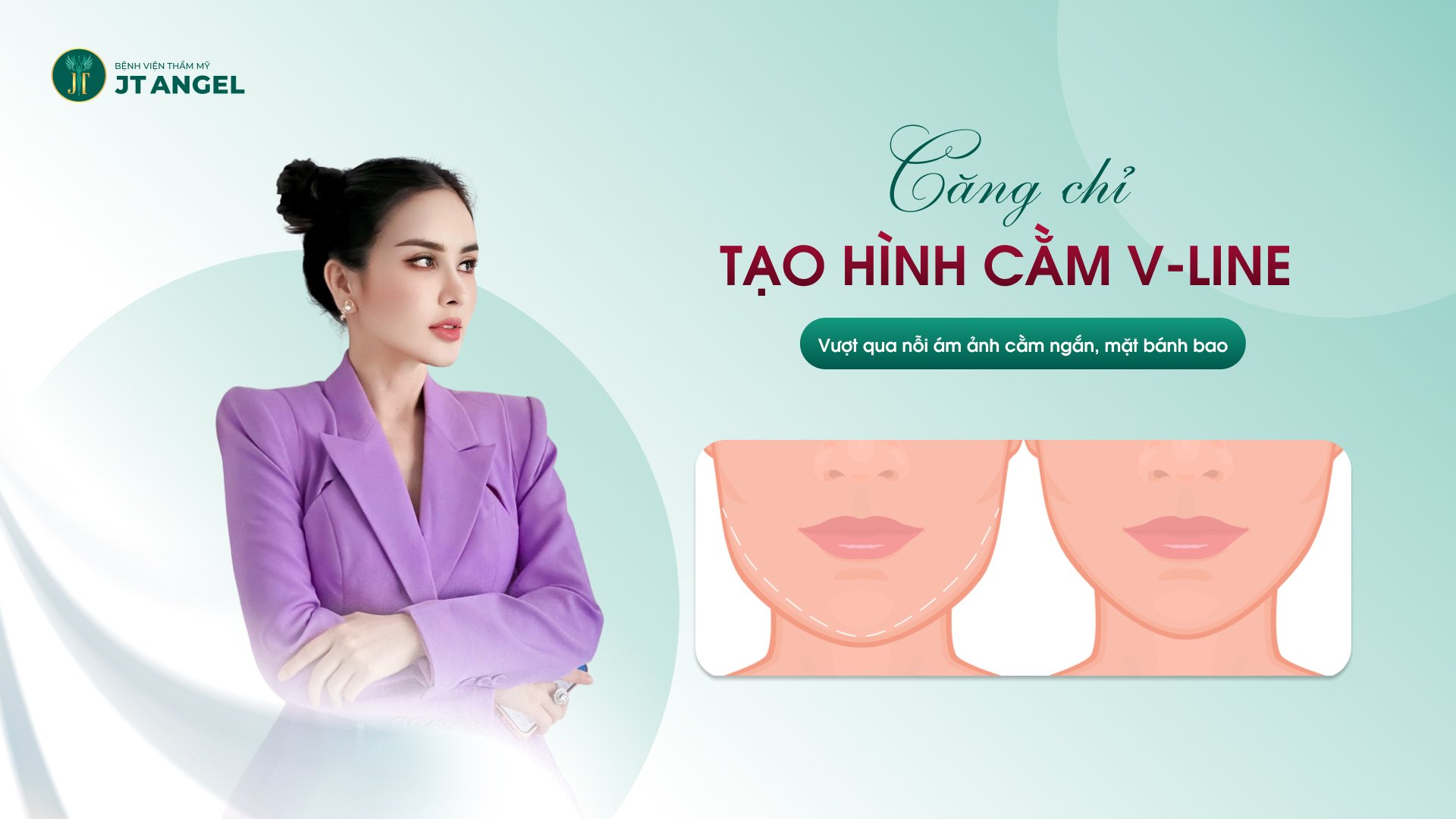 Căng chỉ tạo hình cằm V-line: Vượt qua nỗi ám ảnh cằm ngắn, mặt ...