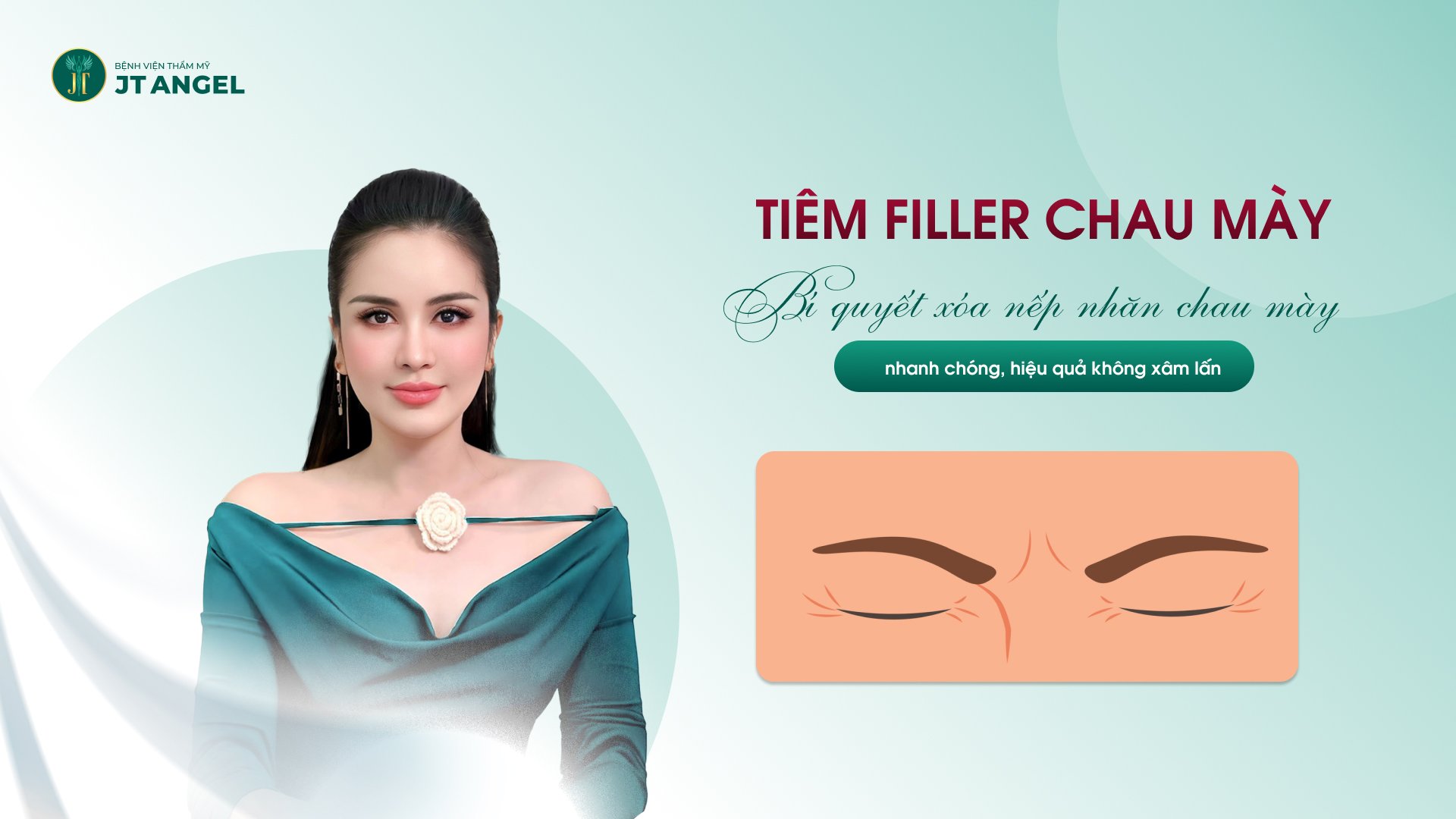 tiem-filler-chau-may-bi-quyet-xoa-nep-nhan-chau-may-nhanh-chong-hieu-qua-khong-xam-lan