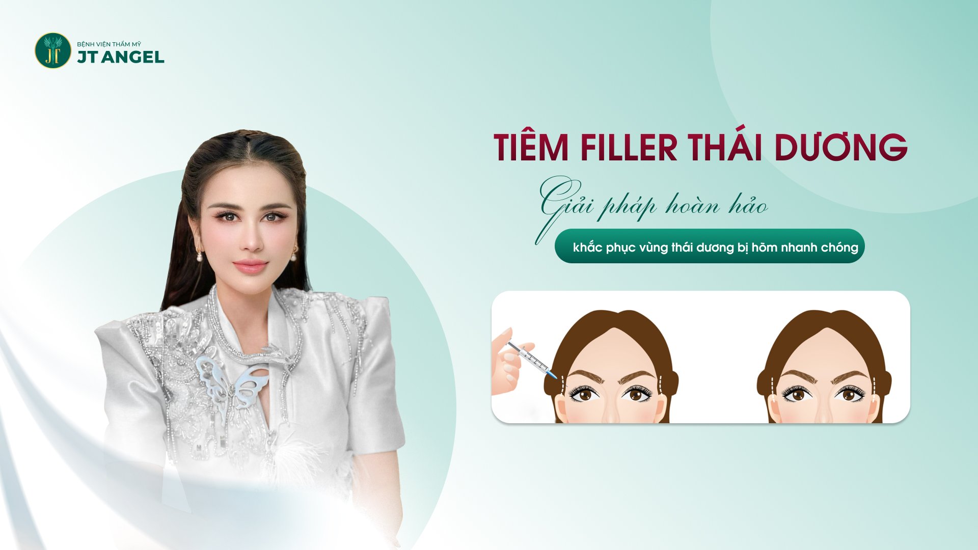 tiem-filler-thai-duong-giai-phap-hoan-hao-khac-phuc-vung-thai-duong-bi-hom-nhanh-chong