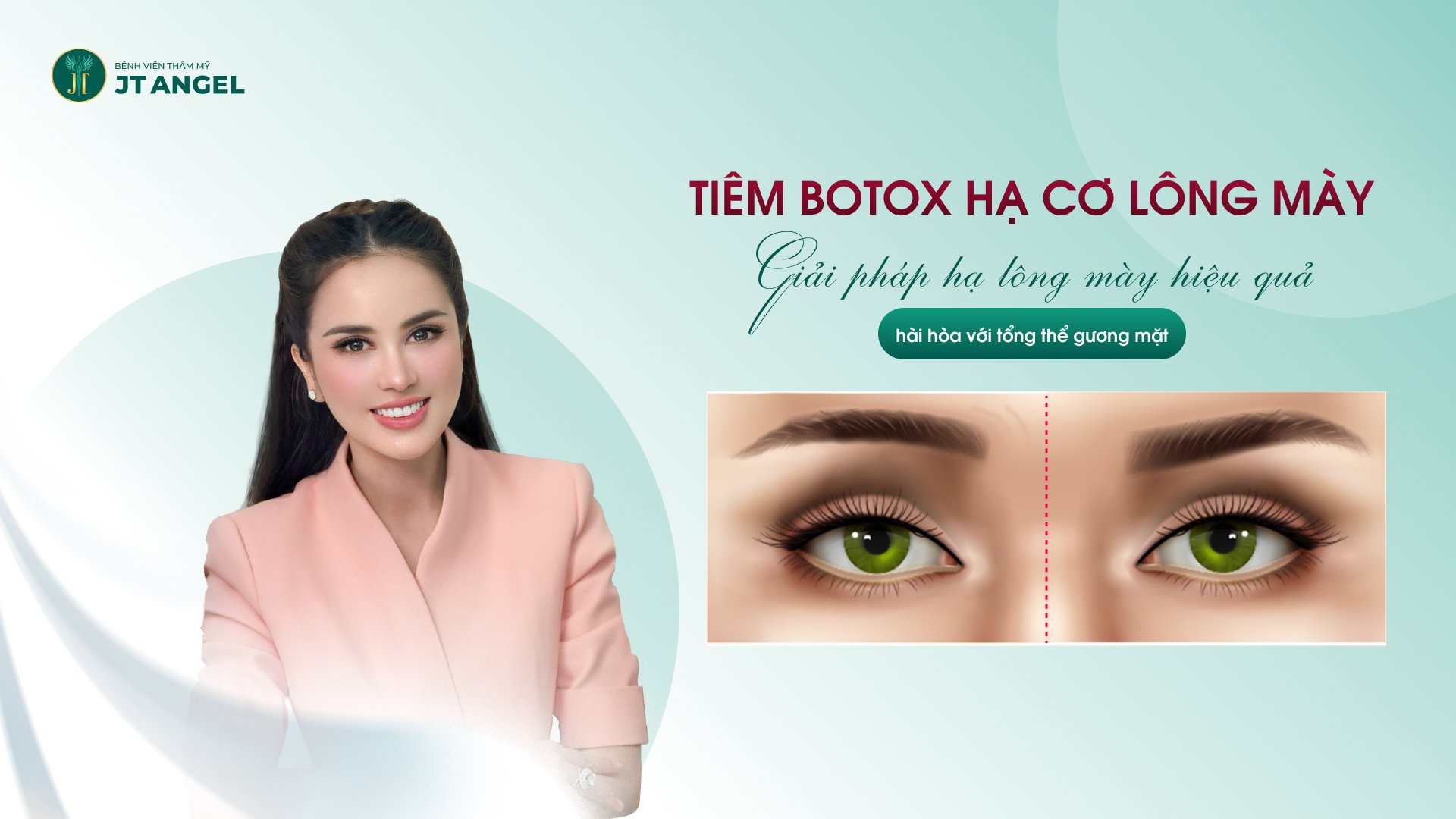 tiem-botox-ha-co-long-may-giai-phap-ha-long-may-hieu-qua-hai-hoa-voi-tong-the-guong-mat