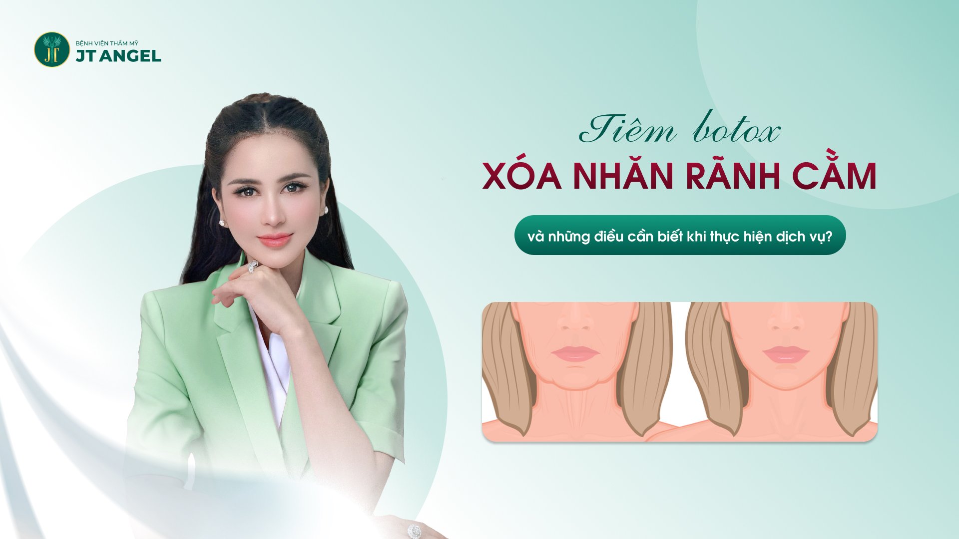 tiem-botox-xoa-nhan-ranh-cam-va-nhung-dieu-can-biet-khi-thuc-hien-dich-vu