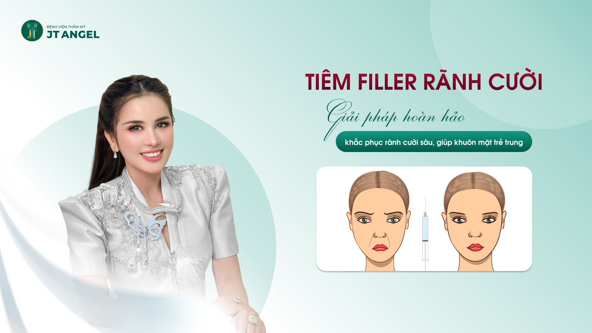 tiem-filler-ranh-cuoi-giai-phap-hoan-hao-khac-phuc-ranh-cuoi-sau-giup-khuon-mat-tre-trung