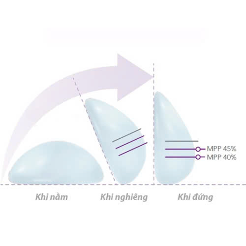 nang-nguc-ergonomix-gia-bao-nhieu-giai-phap-hoan-hao-cho-su-tu-tin