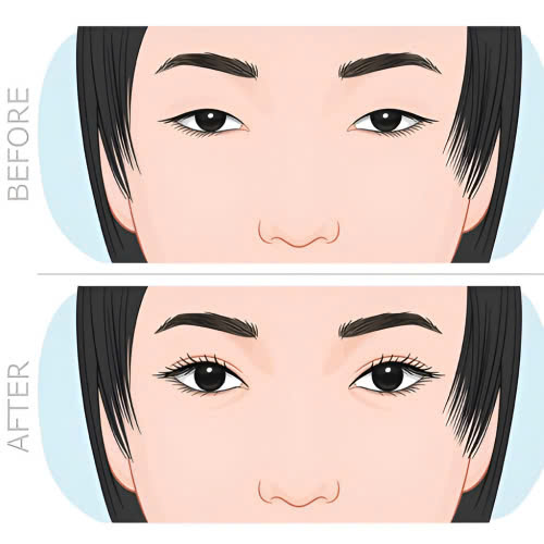 cat-mat-an-bap-nep-duoc-khong-ly-do-tai-sao-ban-can-quan-tam-sau-phau-thuat