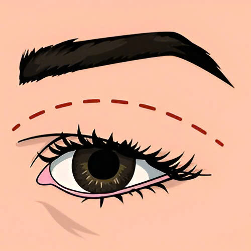 cat-mat-an-ca-tim-duoc-khong-giai-dap-moi-thac-mac