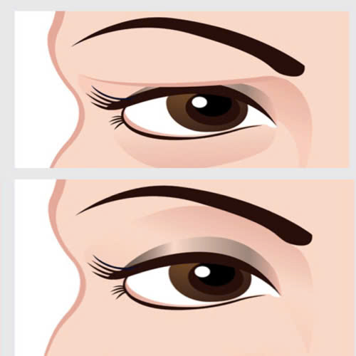 cat-mat-bao-lau-het-sung-nhung-dieu-ban-can-biet-de-phuc-hoi-nhanh-chong