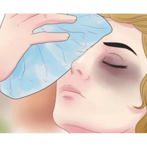 cat-mat-bi-bam-phai-lam-sao-huong-dan-cham-soc-sau-phau-thuat