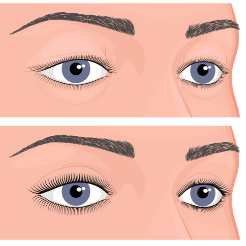 cat-mat-kieng-bia-ruou-bao-lau-tat-ca-nhung-dieu-ban-can-biet