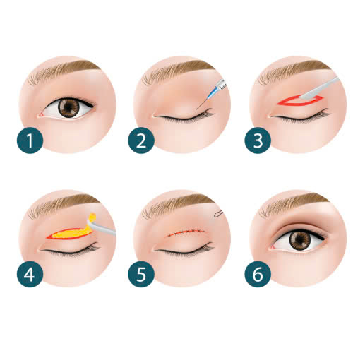 cat-mat-uong-nuoc-ep-gi-tot-goi-y-nuoc-ep-giup-mi-mat-nhanh-lanh