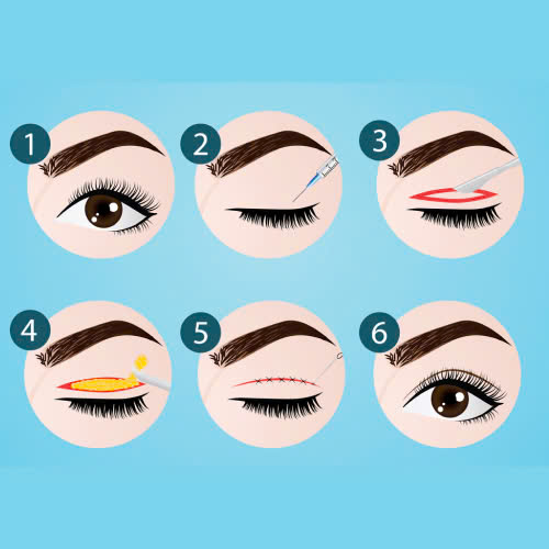 cat-mi-an-khoai-mi-duoc-khong-giai-dap-chi-tiet-va-loi-khuyen-huu-ich