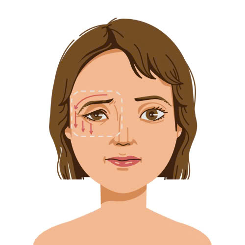 cat-mi-mat-an-khoai-tay-duoc-khong-nhung-dieu-can-luu-y-sau-phau-thuat