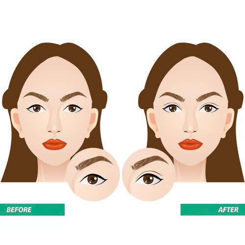 cat-mi-mat-bi-seo-loi-phai-lam-sao-nguyen-nhan-va-cach-xu-ly-hieu-qua