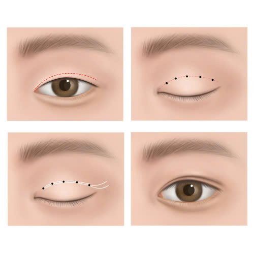 cat-mi-mat-co-uong-collagen-duoc-khong-huong-dan-chi-tiet-cho-ban