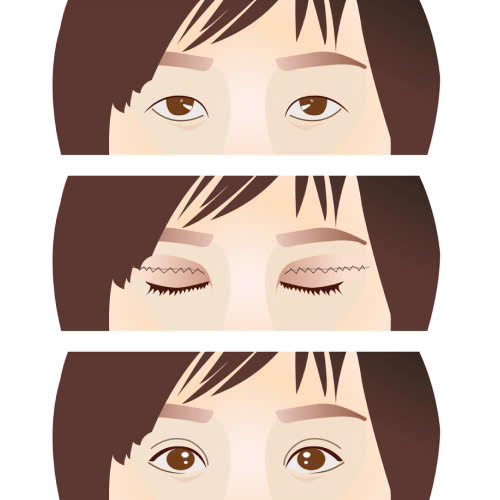 cat-mi-mat-nen-an-trai-cay-gi-de-phuc-hoi-nhanh-va-hieu-qua