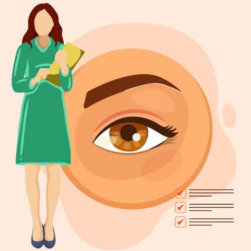 cat-mong-mat-kieng-bao-lau-nhung-dieu-ban-can-biet-de-hoi-phuc-nhanh-chong