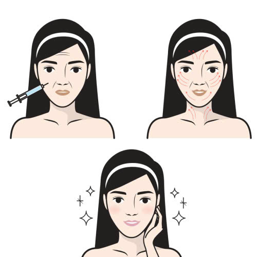 bao-nhieu-tuoi-duoc-tiem-botox-giai-dap-chi-tiet-tu-a-den-z