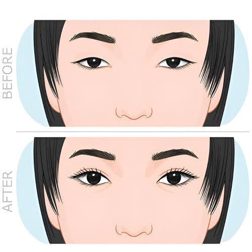 cat-mat-2-mi-cho-nam-gioi-gia-bao-nhieu-giai-dap-chi-tiet-cho-cac-anh-em-nam-gioi