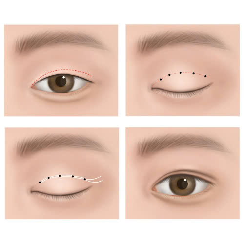 cat-mi-mat-an-dau-phong-duoc-khong-giai-dap-chi-tiet-tu-a-z