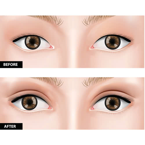 cat-mi-mat-an-dau-phong-duoc-khong-giai-dap-chi-tiet-tu-a-z