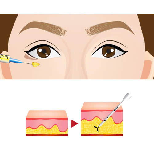 cay-mo-hoc-mat-bao-lau-thi-dep-giai-dap-chi-tiet-huong-dan-cham-soc