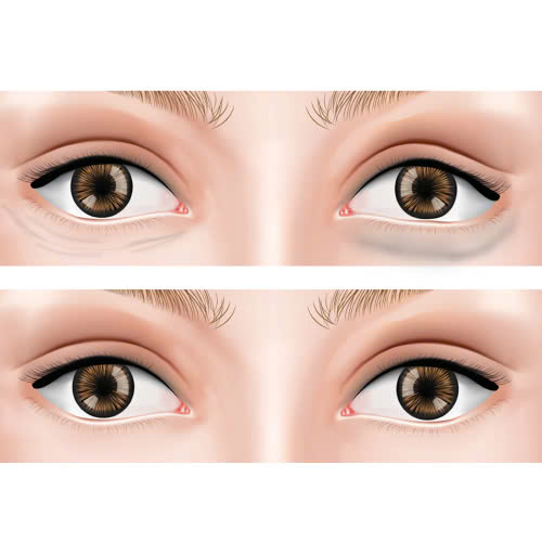 cay-mo-hoc-mat-bao-lau-thi-dep-giai-dap-chi-tiet-huong-dan-cham-soc