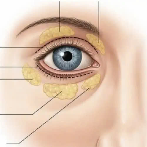 cay-mo-hoc-mat-bao-lau-thi-het-sung-giai-dap-chi-tiet-cach-cham-soc-hieu-qua