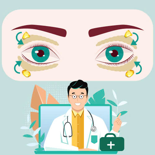 cay-mo-hoc-mat-bao-lau-thi-het-sung-giai-dap-chi-tiet-cach-cham-soc-hieu-qua