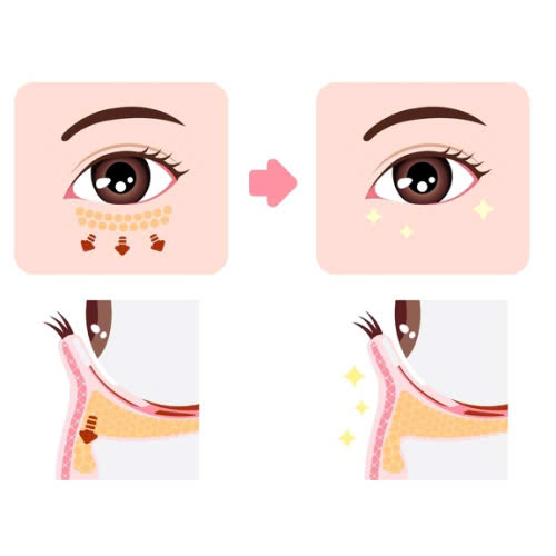 cay-mo-hoc-mat-duy-tri-duoc-bao-lau-giai-dap-chi-tiet-tu-a-den-z