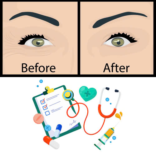 cay-mo-hoc-mat-sau-duy-tri-duoc-bao-lau-giai-dap-chi-tiet