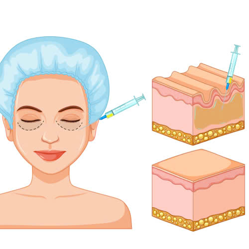 co-nen-cay-mo-hoc-mat-khong-tat-ca-nhung-gi-ban-can-biet