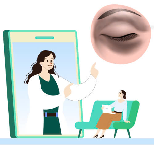 co-nen-cay-mo-hoc-mat-khong-tat-ca-nhung-gi-ban-can-biet