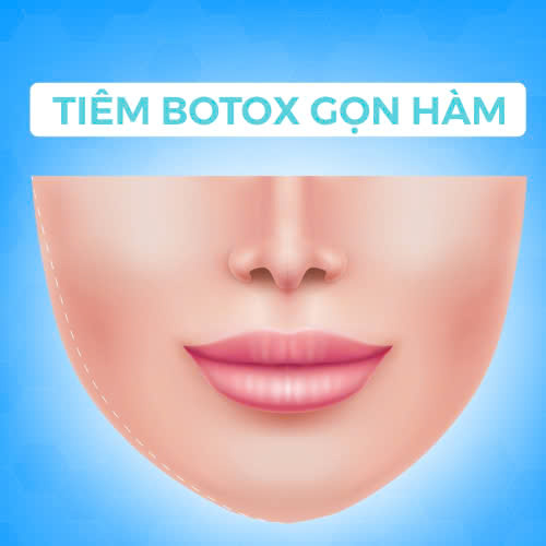co-nen-tiem-botox-gon-ham-khong-ai-phu-hop-voi-phuong-phap-nay