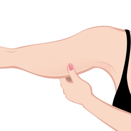 co-nen-tiem-botox-thon-gon-bap-tay-su-that-ban-can-biet-truoc-khi-quyet-dinh