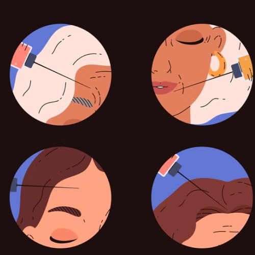 tiem-md-code-kham-pha-cach-tre-hoa-guong-mat-va-tao-duong-net-tuoi-tre