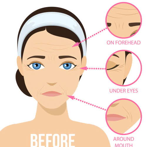 sau-khi-tiem-botox-can-kieng-gi-huong-dan-chi-tiet-de-duy-tri-hieu-qua-toi-da