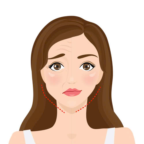 sau-khi-tiem-botox-thon-gon-ham-nen-kieng-gi-huong-dan-chi-tiet-cho-cac-chi-em