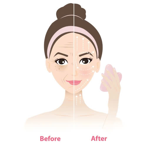 tiem-botox-bao-lau-co-hieu-qua-bat-mi-thoi-gian-thay-ket-qua-nhanh