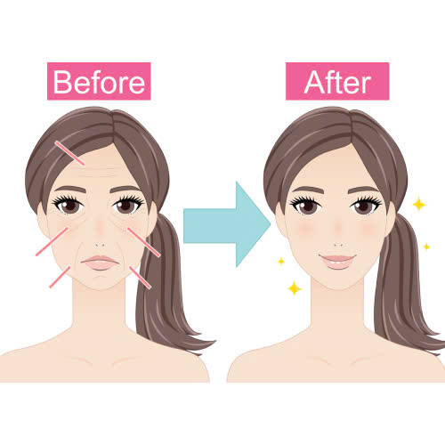 tiem-botox-bao-lau-co-hieu-qua-bat-mi-thoi-gian-thay-ket-qua-nhanh