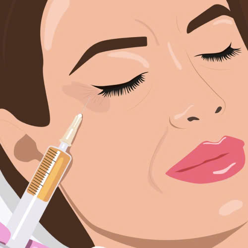 tiem-botox-bao-lau-thi-tan-giai-dap-chi-tiet-va-nhung-dieu-can-biet