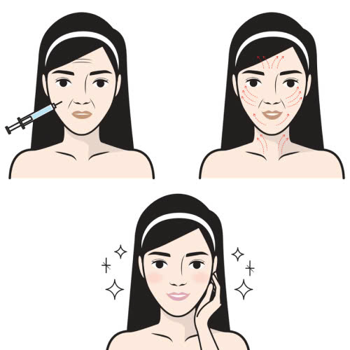 tiem-botox-co-an-toan-khong-tat-tan-tat-nhung-dieu-ban-can-biet