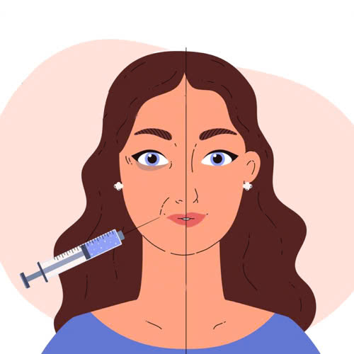 tiem-botox-cuoi-bi-do-nguyen-nhan-cach-khac-phuc-va-luu-y-quan-trong