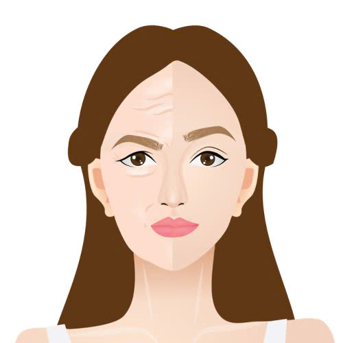 tiem-botox-dung-de-lam-gi-nhung-cong-dung-tuyet-voi-cua-botox-trong-lam-dep