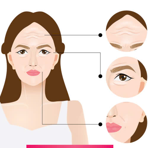 tiem-botox-dung-de-lam-gi-nhung-cong-dung-tuyet-voi-cua-botox-trong-lam-dep