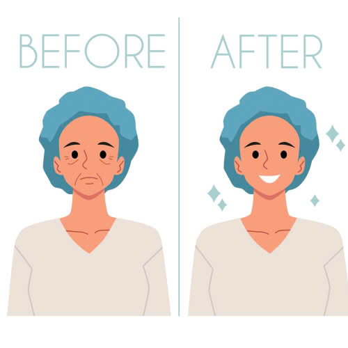 tiem-botox-duy-tri-duoc-bao-lau-tat-tan-tat-nhung-dieu-ban-can-biettiem-botox-duy-tri-duoc-bao-lau-tat-tan-tat-nhung-dieu-ban-can-biet